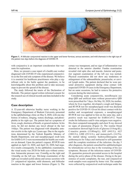 Solution Conjunctivitis As Sole Symptom Of D Acovid Studypool