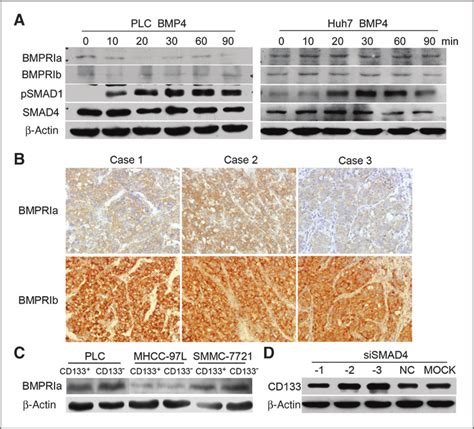 The Expression And Activation Of Bmp Receptors In Hcc Cell Lines And