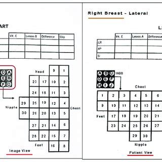 Examples Of The Charts Used For Manual Targeting During MRI Breast