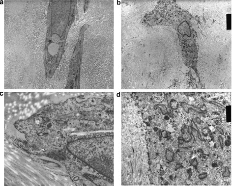 A Electron Micrograph Of Mature Myofibroblasts Original