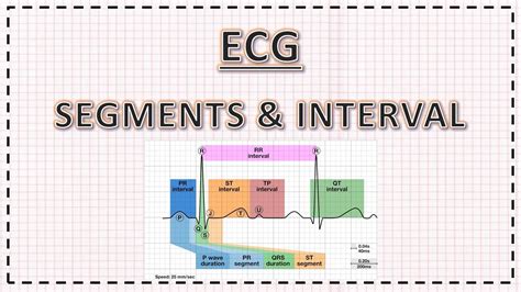 Ecg Segments Intervals J Point Corrected Qt Interval Pr Interval