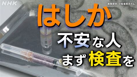 はしか 全国で感染確認相次ぐ “不安な大人はまず検査を” Nhk 医療・健康