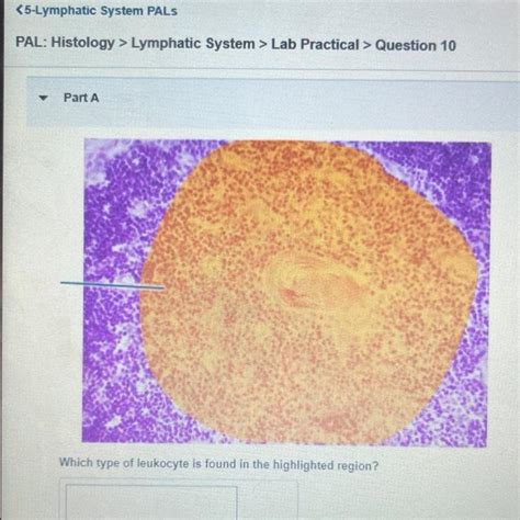 Solved C Lymphatic System Pals Pal Histology Lymphatic Chegg