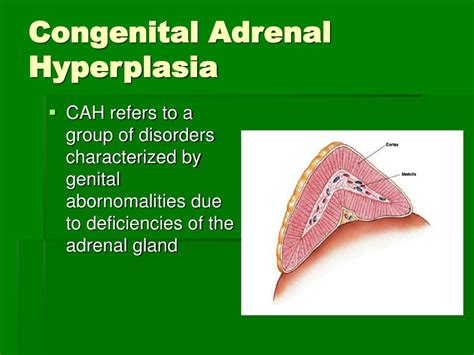 Congenital Adrenal Hyperplasia