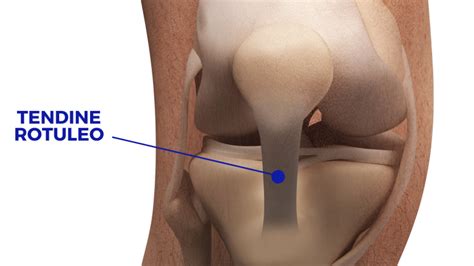 Tendinite Ginocchio Sintomi Cura Ed Esercizi Dott Valerio Barbari