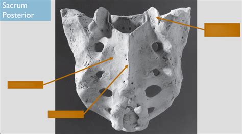 Sacrum Bony Features Posterior Diagram Quizlet