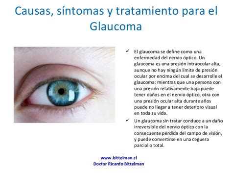 Glaucoma Causas Y Tratamiento Ricardo Bittelman