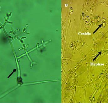 Microscopic Structures Of Trichoderma Sp A Conidiogenic Cells X40