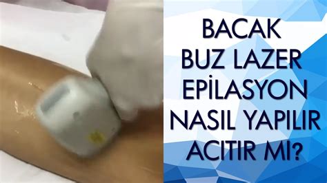 Bacak Buz Lazer Epilasyon Nasıl Yapılır Acıtır Mı I How to do ice