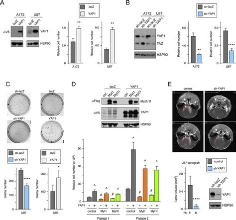 Myt1 And Myt1l Transcription Factors Limit Proliferation In Gbm Cells