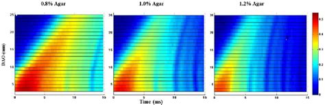 Figure 4 From Shear Wave Elasticity Imaging Based On Acoustic Radiation