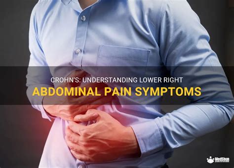 Crohn S Understanding Lower Right Abdominal Pain Symptoms Medshun