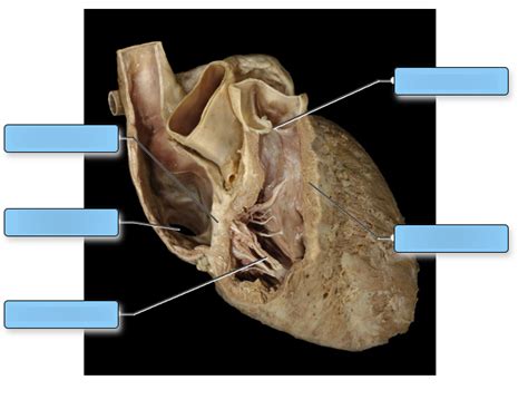 Labeling the Cadaver Heart: Internal Anatomy 1 Diagram | Quizlet