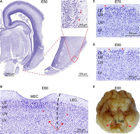 Frontiers Development Of The Entorhinal Cortex Occurs Via Parallel