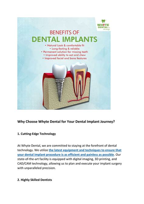 Ppt Celebrate Your Perfect Smile Transformation With State Of The Art Dental Implants In