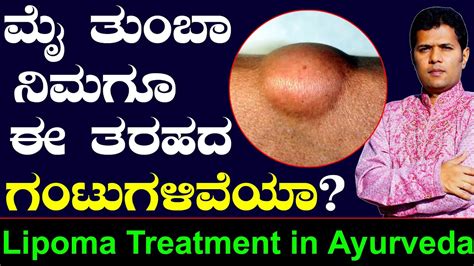 Lipoma Treatment At Home In Kannada Ayurveda Tips In Kannada Health