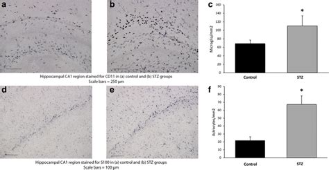 The Acute Effect Of Stz Induced Hyperglycemia On Microgliosis And