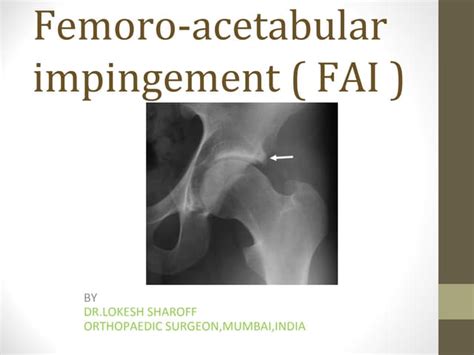 Femoro Acetabular Impingement Fai Causes Classification Clinical