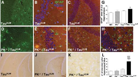 Astrogliosis And Microgliosis In The Hippocampus Of 12 Month Old Tau