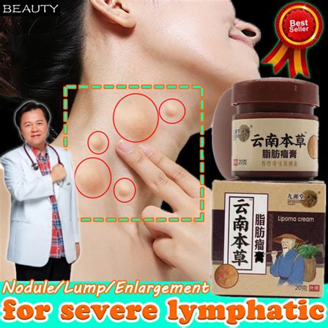 Lipoma Removal Cream Treat Tumor Skin Swelling Ointment Herbal 20g