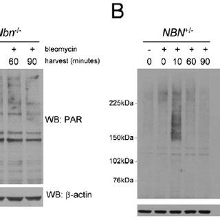 Increased PARP Activity In Nbn 2 2 Murine Fibroblasts And NBS Patient