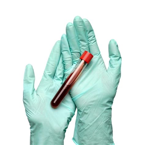 Premium Photo Hand In Latex Glove Holding Blood Sample In Test Tube