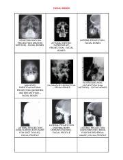 Posi Act Images Docx Facial Bones Parietoacanthial Projection