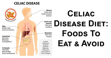 Celiac Disease Diet Foods To Eat And Avoid David Avocado Wolfe