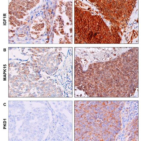 Examples Of Representative Positive Immunohistochemical Staining For