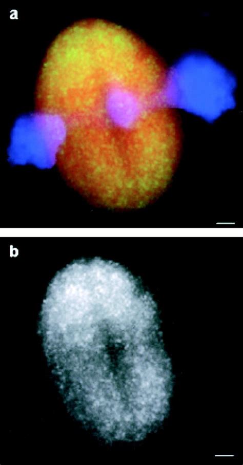 Inhibition Of Eg5 Motility Does Not Accumulate The Motor At Spindle