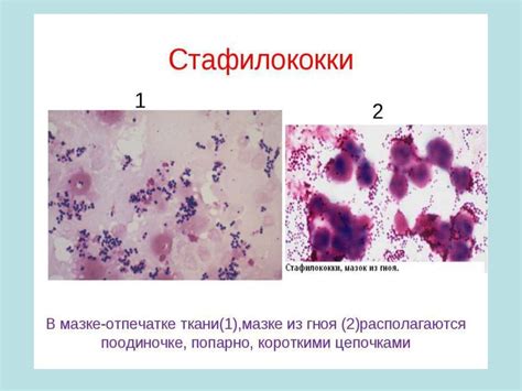 Стафилококки. Стрептококки - презентация онлайн