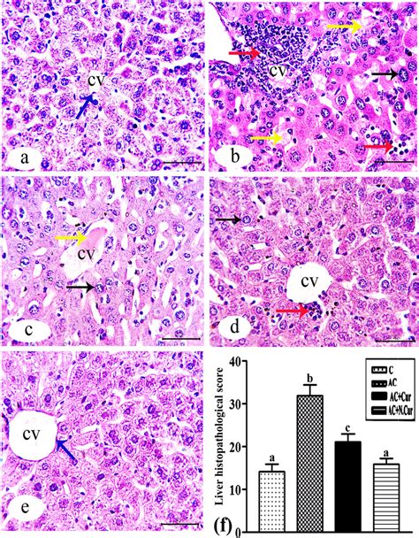 A E Photomicrograph Of H E Stained Liver Sections From The