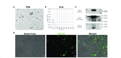 Characterization Of Exosomes Extracted From Conditioned Medium Of Oscc