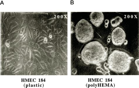 Morphology Of Hmec Cultured Under Proliferation Or Differentiation