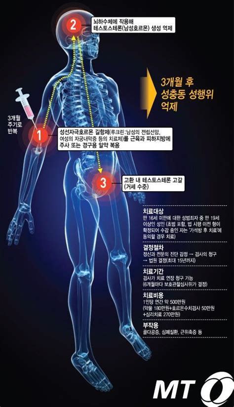 더쿠 화학적 거세란 무엇인가