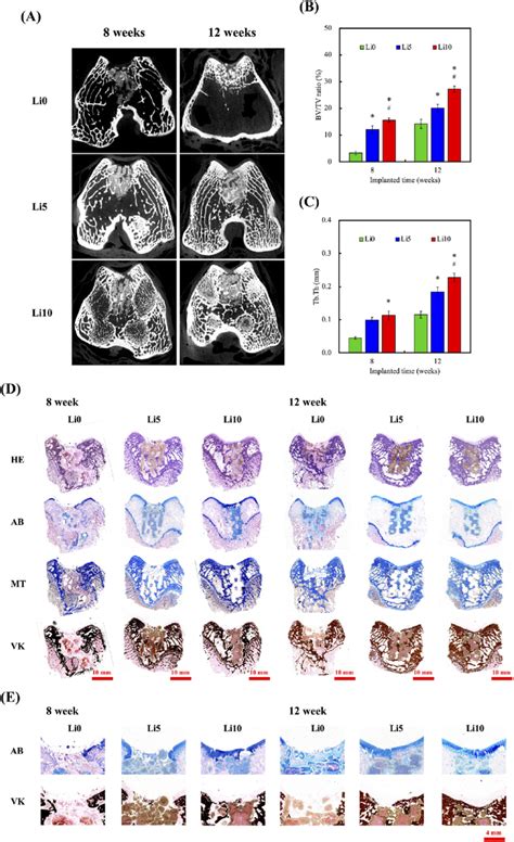 The Evaluation Of The Implanted Scaffolds Using Micro Ct Imaging