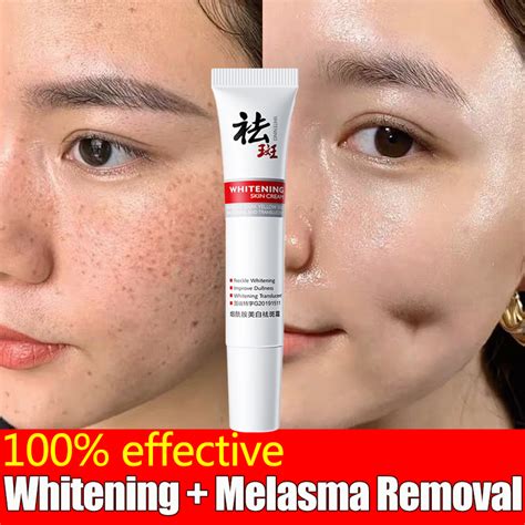 ZHIDUO Genuine Freckle Removal Whitening Cream Original Facial