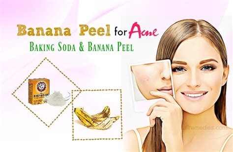 11 Ways How To Use Banana Peel For Acne & Pimples – Does It Work?