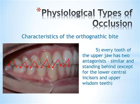 Orthodontics Definitions Stages Of Development Problems Structure