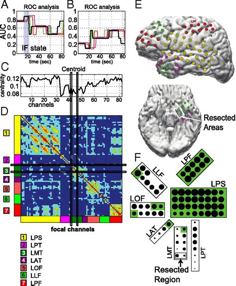 Network Dynamics Of The Brain And Influence Of The Epileptic Seizure