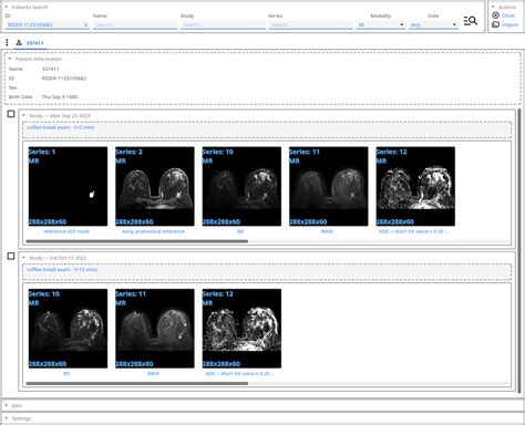 New Feature Visual Dicom Browser Support 3d Slicer Community