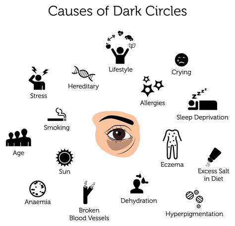 What Causes Dark Circles Around The Eyes