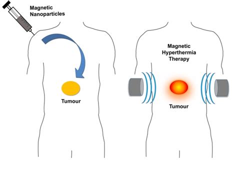 Introduction Magnetic Nanoparticle Hyperthermia Magnanotherm