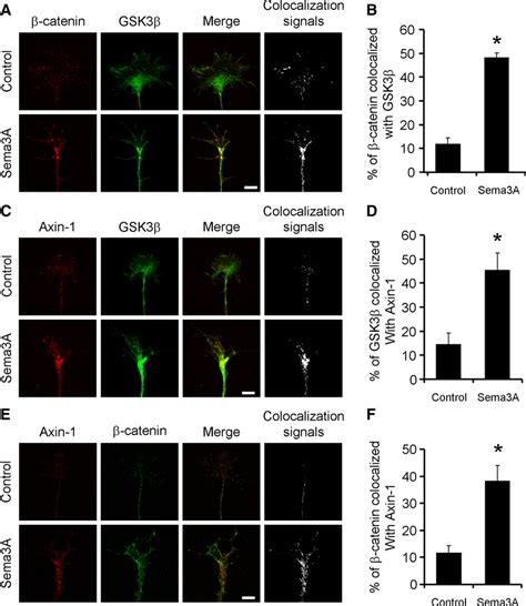 Sema A Enhances Colocalization Of Catenin Gsk And Axin In Drg