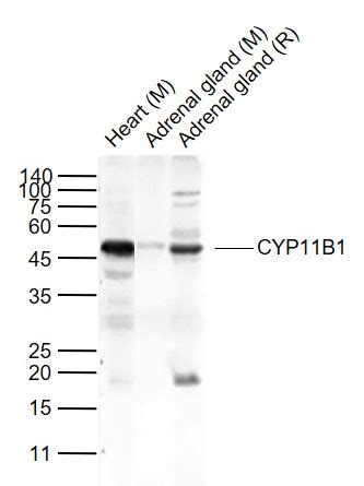 CYP11B1 Polyclonal Antibody – Bioss