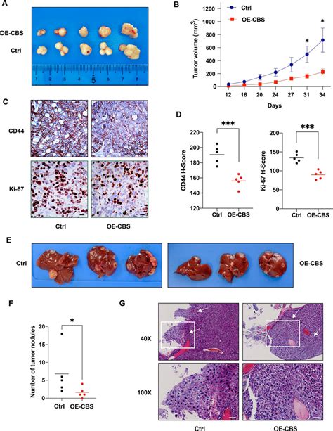 Overexpression Of Cbs Attenuates Crc Cell Growth And Liver Metastasis