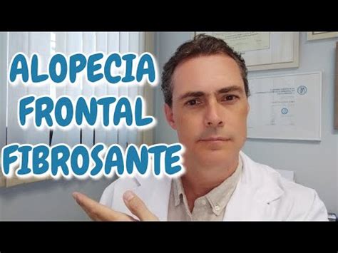 Dermatólogo explica qué es la alopecia frontal fibrosante YouTube