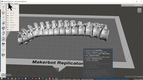 Ct Or Mri To D Print Dicom To Stl With Local Computer Part Of