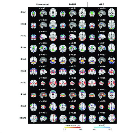 Ten Group Rsns Identified On Left Uncorrected Middle Topup