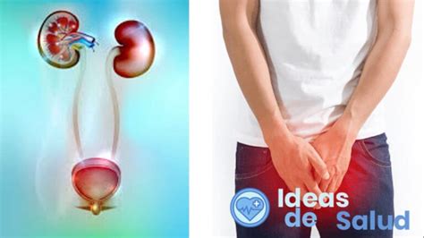 Ardor al orinar en los hombres Qué puede ser 2025 Ideas de Salud